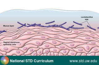 Diagnosis: Bacterial vaginosis (BV), Clinical Signs: N/A, Locations: N/A, Symptoms: N/A, Image Type: Illustration