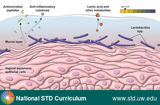 Diagnosis: Bacterial vaginosis (BV), Clinical Signs: N/A, Locations: N/A, Symptoms: N/A, Image Type: Illustration