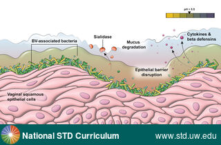 Diagnosis: Bacterial vaginosis (BV), Clinical Signs: N/A, Locations: N/A, Symptoms: N/A, Image Type: Illustration