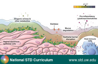 Diagnosis: Bacterial vaginosis (BV), Clinical Signs: N/A, Locations: N/A, Symptoms: N/A, Image Type: Illustration