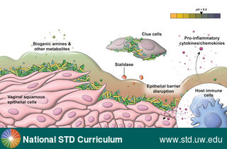 Diagnosis: Bacterial vaginosis (BV), Clinical Signs: N/A, Locations: N/A, Symptoms: N/A, Image Type: Illustration
