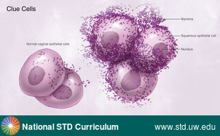 Diagnosis: Bacterial vaginosis (BV), Clinical Signs: N/A, Locations: Microscope, Symptoms: N/A, Image Type: Illustration