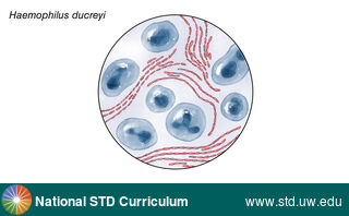 Diagnosis: Chancroid, Clinical Signs: N/A, Locations: Microscope-Gram Stain, Symptoms: N/A, Image Type: Illustration