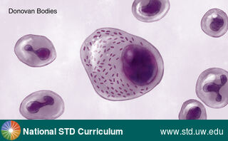 Diagnosis: Granuloma inguinale, Clinical Signs: N/A, Locations: Microscope, Symptoms: N/A, Image Type: Illustration