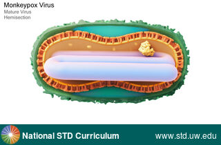 Diagnosis: Mpox, Clinical Signs: N/A, Locations: N/A, Symptoms: N/A, Image Type: Illustration