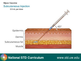 Diagnosis: Mpox, Clinical Signs: N/A, Locations: N/A, Symptoms: N/A, Image Type: Illustration