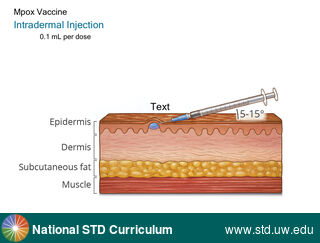 Diagnosis: Mpox, Clinical Signs: N/A, Locations: N/A, Symptoms: N/A, Image Type: Illustration