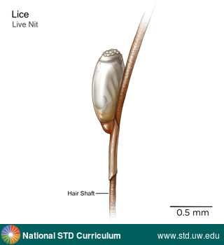 Diagnosis: Lice / Crabs, Clinical Signs: N/A, Locations: N/A, Symptoms: N/A, Image Type: Illustration
