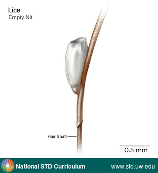 Diagnosis: Lice / Crabs, Clinical Signs: N/A, Locations: N/A, Symptoms: N/A, Image Type: Illustration