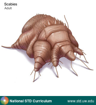 Diagnosis: Scabies, Clinical Signs: N/A, Locations: Microscope, Symptoms: N/A, Image Type: Illustration