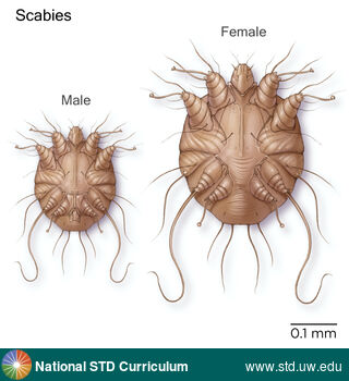 Diagnosis: Scabies, Clinical Signs: N/A, Locations: Microscope, Symptoms: N/A, Image Type: Illustration