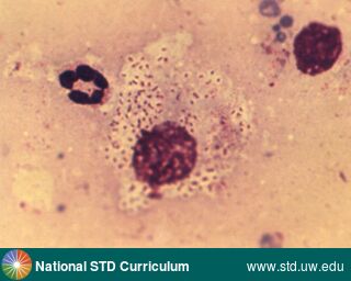 Diagnosis: Granuloma inguinale, Clinical Signs: N/A, Locations: Microscope, Symptoms: N/A, Image Type: Photo