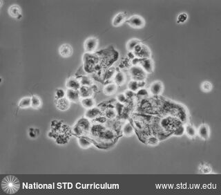 Diagnosis: Trichomoniasis,  Clinical Signs: N/A,  Locations: Microscope-Wet Mount, Symptoms: N/A,  Image Type: Photo