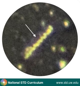 Diagnosis: Syphilis-Spirochete,  Clinical Signs: N/A,  Locations: Microscope-Darkfield, Symptoms: N/A,  Image Type: Photo