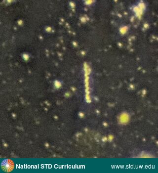 Diagnosis: Syphilis-Spirochete,  Clinical Signs: N/A,  Locations: Microscope-Darkfield, Symptoms: N/A,  Image Type: Photo