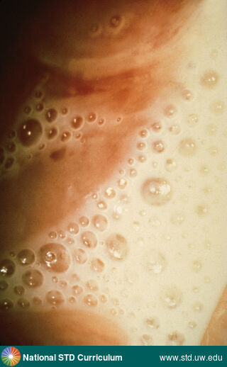 Diagnosis: Trichomoniasis, Clinical Signs: N/A, Locations: Microscope, Symptoms: N/A, Image Type: Photo