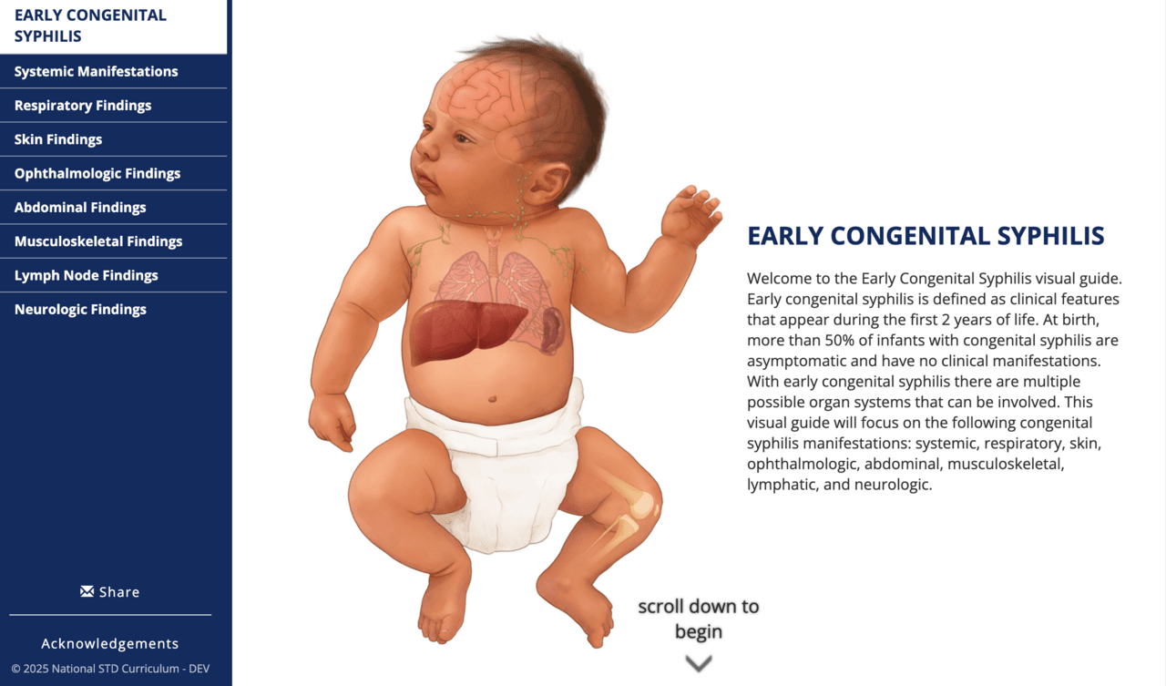 Core Concepts - Syphilis During Pregnancy and Congenital Syphilis ...