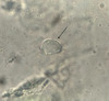 The oval organism in the center of the slide (black arrow) was motile when observed under the microscope.