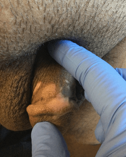 Hypopigmented Macules on Penis